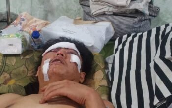 Kapolsek Kikim Timur Dinilai Lamban, Dalam Menangani Kasus Penganiayaan Korban Muhammad Yoevy Herlambang
